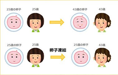 卵子凍結のメリット