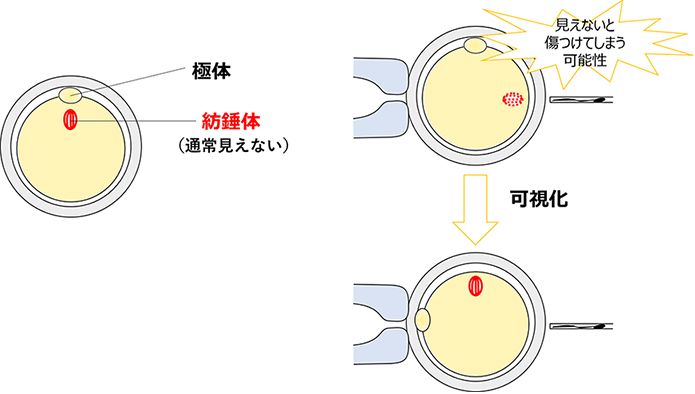 紡錘体観察