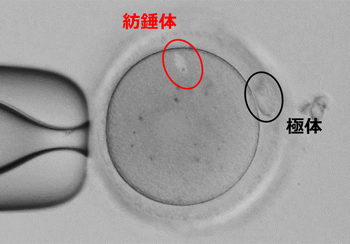 紡錘体観察