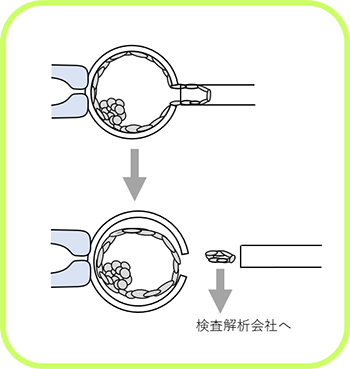 着床前検査について